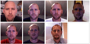 Hair Growth